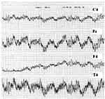 MRET EEG Test 3