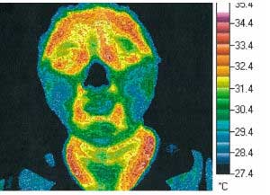MRET Thermography Test 3 - with MRET-shield protection