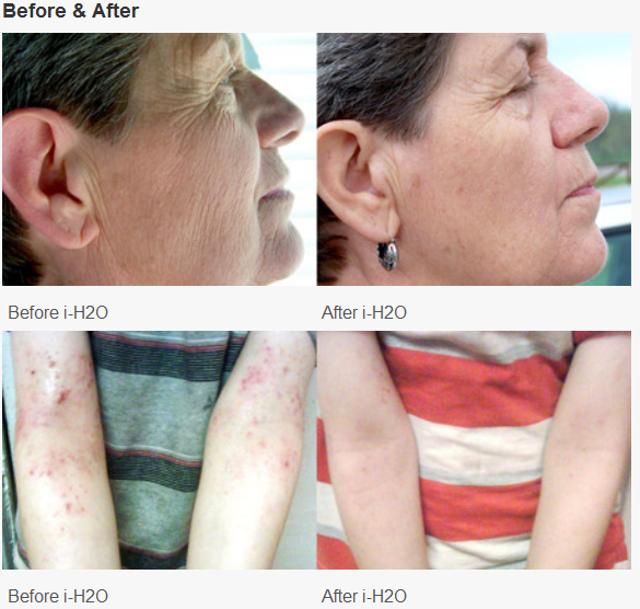 GIA iH2O *MRET Water) Before & After